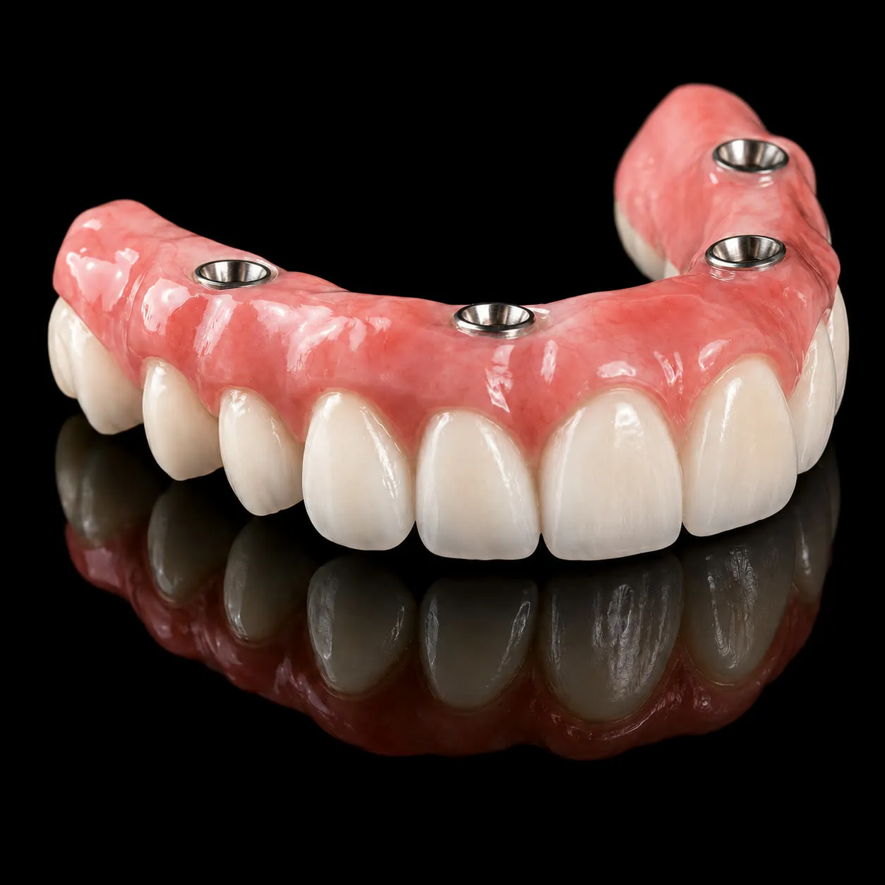 Prótese protocolo: arcada completa de dentes fixos sobre implantes