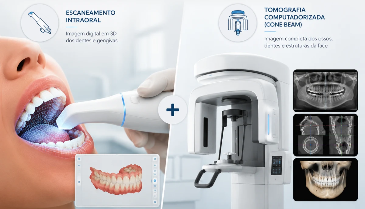 Escaneamento intraoral 3D + tomografia computadorizada cone beam